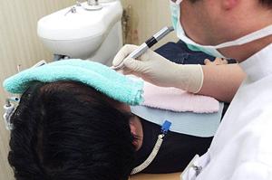 希望のスタイルに仕上がる医療用ウィッグ