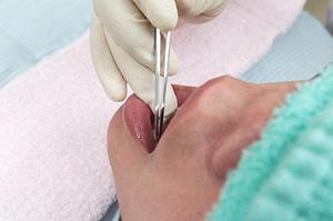 波動治療の効果と魅力を徹底解説！美容と健康に取り入れる方法