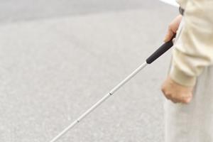 インプラントによる不安を取り除きます